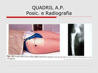 QUADRIL A.P.
Posic. e Radiografia
 