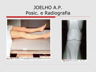 JOELHO A.P.
Posic. e Radiografia
 