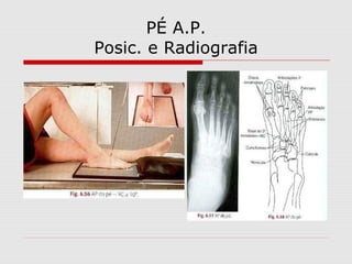 PÉ A.P.
Posic. e Radiografia
 