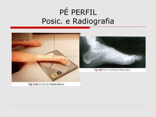 PÉ PERFIL
Posic. e Radiografia
 