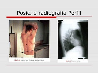 Posic. e radiografia Perfil
 
