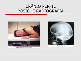 CRÂNIO PERFIL
POSIC. E RADIOGRAFIA
 