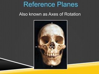 Also known as Axes of Rotation
Reference Planes
 
