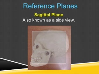 Reference Planes
Sagittal Plane
Also known as a side view.
 