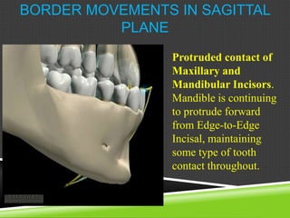 BORDER MOVEMENTS IN SAGITTAL
PLANE
Protruded contact of
Maxillary and
Mandibular Incisors.
Mandible is continuing
to protrude forward
from Edge-to-Edge
Incisal, maintaining
some type of tooth
contact throughout.
 