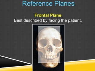 Reference Planes
Frontal Plane
Best described by facing the patient.
 