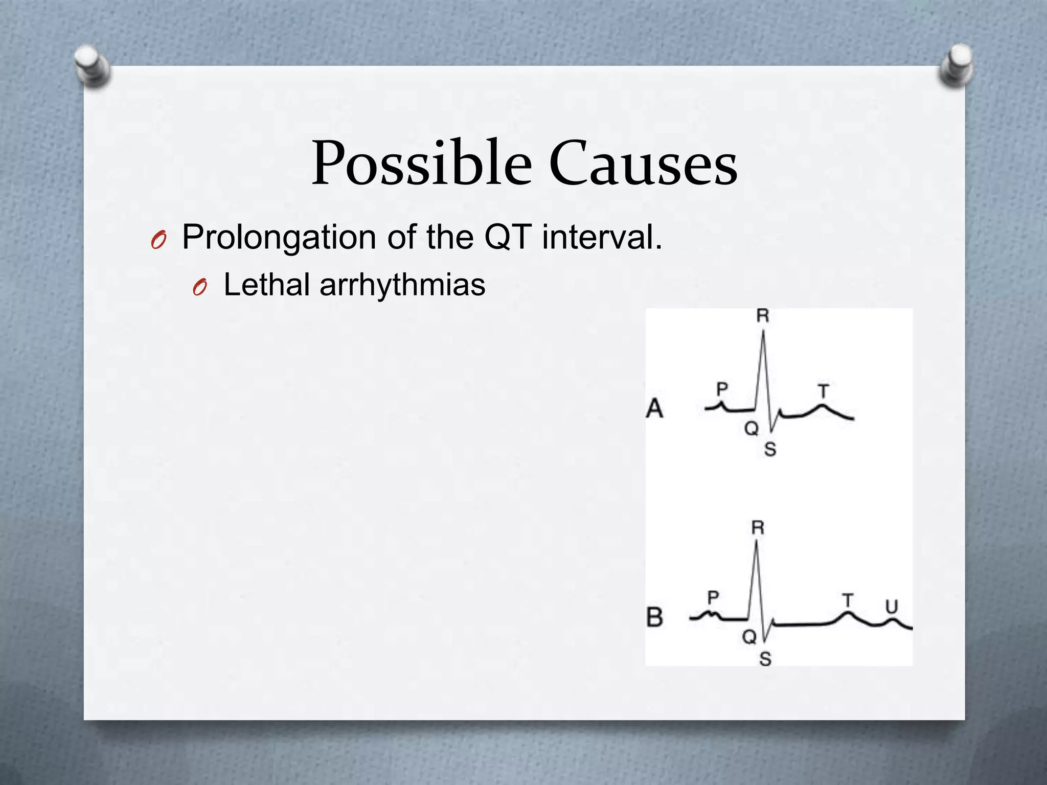 The Unexpected Causes Of Brinalexia - muybydj