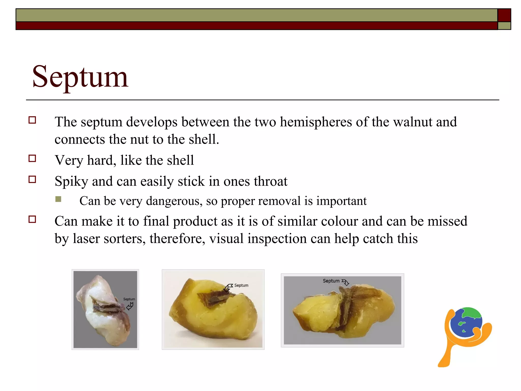 Septum
 The septum develops between the two hemispheres of the walnut and
connects the nut to the shell.
 Very hard, like the shell
 Spiky and can easily stick in ones throat
 Can be very dangerous, so proper removal is important
 Can make it to final product as it is of similar colour and can be missed
by laser sorters, therefore, visual inspection can help catch this
 