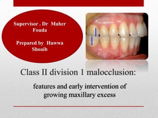 Supervisor . Dr Maher
Fouda
Prepared by Hawwa
Shoaib
Class II division 1 malocclusion:
features and early intervention of
growing maxillary excess
 