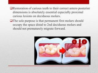 Restoration of carious teeth to their correct antero posterior
dimensions is absolutely essential especially proximal
carious lesions on deciduous molars.
The sole purpose is that permanent first molars should
occupy the space distal to 2nd deciduous molars and
should not prematurely migrate forward.
6
E
 