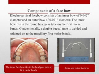 Components of a face bow
Kloehn cervical facebow consists of an inner bow of 0.045"
diameter and an outer bow of 0.071" diameter. The inner
bow fits in the round headgear tube on the first molar
bands. Conventionally, a double buccal tube is welded and
soldered on to the maxillary first molar bands..
The inner face bow fits in the headgear tube on
first molar bands
Inner and outer facebow
 