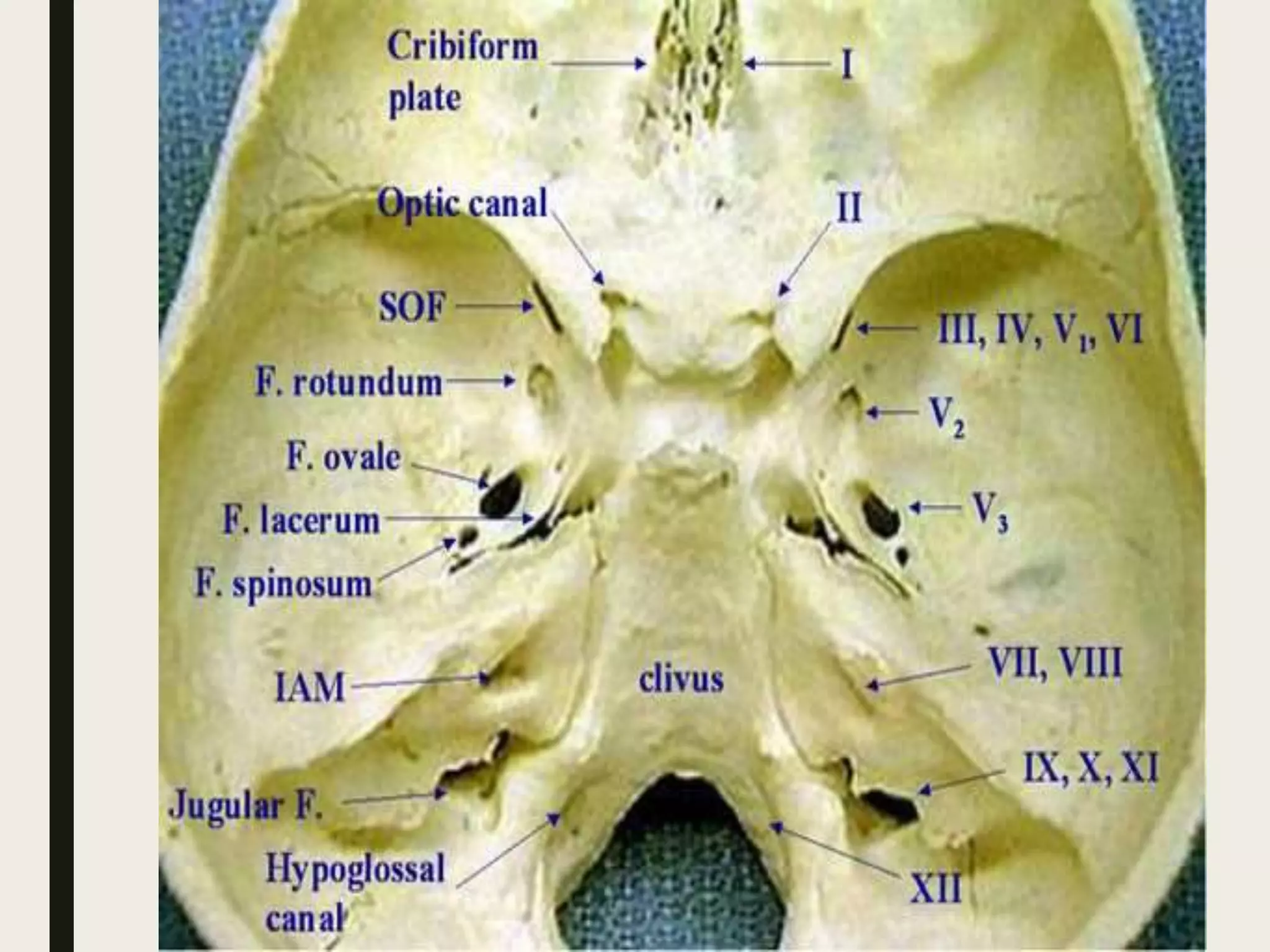posterior-cranial-fossa-with-cranial-nerves-relation-pptx