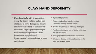 CLAW HAND DEFORMITY
• Claw hand deformity is a condition
where the fingers curl into a claw-like
shape due to nerve damage and muscle
imbalance in the hand. It features bent
middle and finger tips (interphalangeal
flexion) alongside pulled-back base
joints (metacarpophalangeal
hyperextension), commonly tied to ulnar
nerve injury
• Signs and Symptoms
• Fingers stuck or bent in a claw posture
(frequently the ring and little fingers)
• Trouble straightening or extending the fingers
• Numbness, tingling, or loss of feeling in the hand
and specific fingers
• Weak grip and loss of fine motor coordination
• Wasting or thinning of the small muscles in the
palm and between bones
 