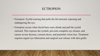 ECTROPION
• Ectropion: Eyelid scarring that pulls the lid outward, exposing and
endangering the eye.
• Ectropion occurs when facial burn scars shrink and pull the eyelid
outward. This exposes the eyeball, prevents complete eye closure, and
causes severe dryness, corneal ulcers, and potential vision loss. Treatment
requires urgent eye lubrication and surgical scar release with skin grafts.
 