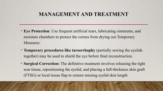 MANAGEMENT AND TREATMENT
• Eye Protection: Use frequent artificial tears, lubricating ointments, and
moisture chambers to protect the cornea from drying out.Temporary
Measures:
• Temporary procedures like tarsorrhaphy (partially sewing the eyelids
together) may be used to shield the eye before final reconstruction.
• Surgical Correction: The definitive treatment involves releasing the tight
scar tissue, repositioning the eyelid, and placing a full-thickness skin graft
(FTSG) or local tissue flap to restore missing eyelid skin length
 