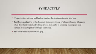 SYNDACTYLY
• Fingers or toes sticking and healing together due to circumferential skin loss.
• Post-burn syndactyly is the abnormal fusing or webbing of adjacent fingers. It happens
when deep hand burns heal without proper skin grafts or splinting, causing raw skin
surfaces to stick together with tight scar tissue.
• This limits hand movement and grip.
 