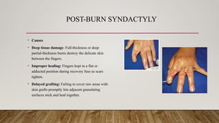 POST-BURN SYNDACTYLY
• Causes
• Deep tissue damage: Full-thickness or deep
partial-thickness burns destroy the delicate skin
between the fingers.
• Improper healing: Fingers kept in a flat or
adducted position during recovery fuse as scars
tighten.
• Delayed grafting: Failing to cover raw areas with
skin grafts promptly lets adjacent granulating
surfaces stick and heal together.
 