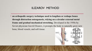 ILIZAROV METHOD
• an orthopedic surgery technique used to lengthen or reshape bones
through distraction osteogenesis, relying on a circular external metal
frame and gradual mechanical stretching. Developed in the 1950s by
Soviet physician Gavriil Ilizarov, it prompts the body to naturally grow new
bone, blood vessels, and soft tissue.
 