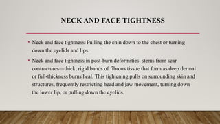 NECK AND FACE TIGHTNESS
• Neck and face tightness: Pulling the chin down to the chest or turning
down the eyelids and lips.
• Neck and face tightness in post-burn deformities stems from scar
contractures—thick, rigid bands of fibrous tissue that form as deep dermal
or full-thickness burns heal. This tightening pulls on surrounding skin and
structures, frequently restricting head and jaw movement, turning down
the lower lip, or pulling down the eyelids.
 