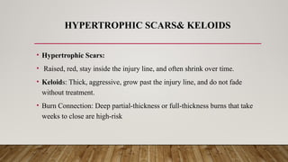 HYPERTROPHIC SCARS& KELOIDS
• Hypertrophic Scars:
• Raised, red, stay inside the injury line, and often shrink over time.
• Keloids: Thick, aggressive, grow past the injury line, and do not fade
without treatment.
• Burn Connection: Deep partial-thickness or full-thickness burns that take
weeks to close are high-risk
 