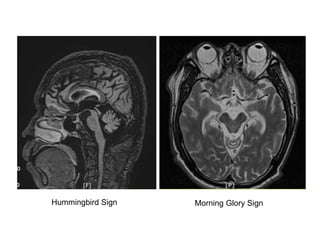 Hummingbird Sign Morning Glory Sign
 