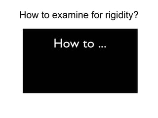 How to examine for rigidity?
 