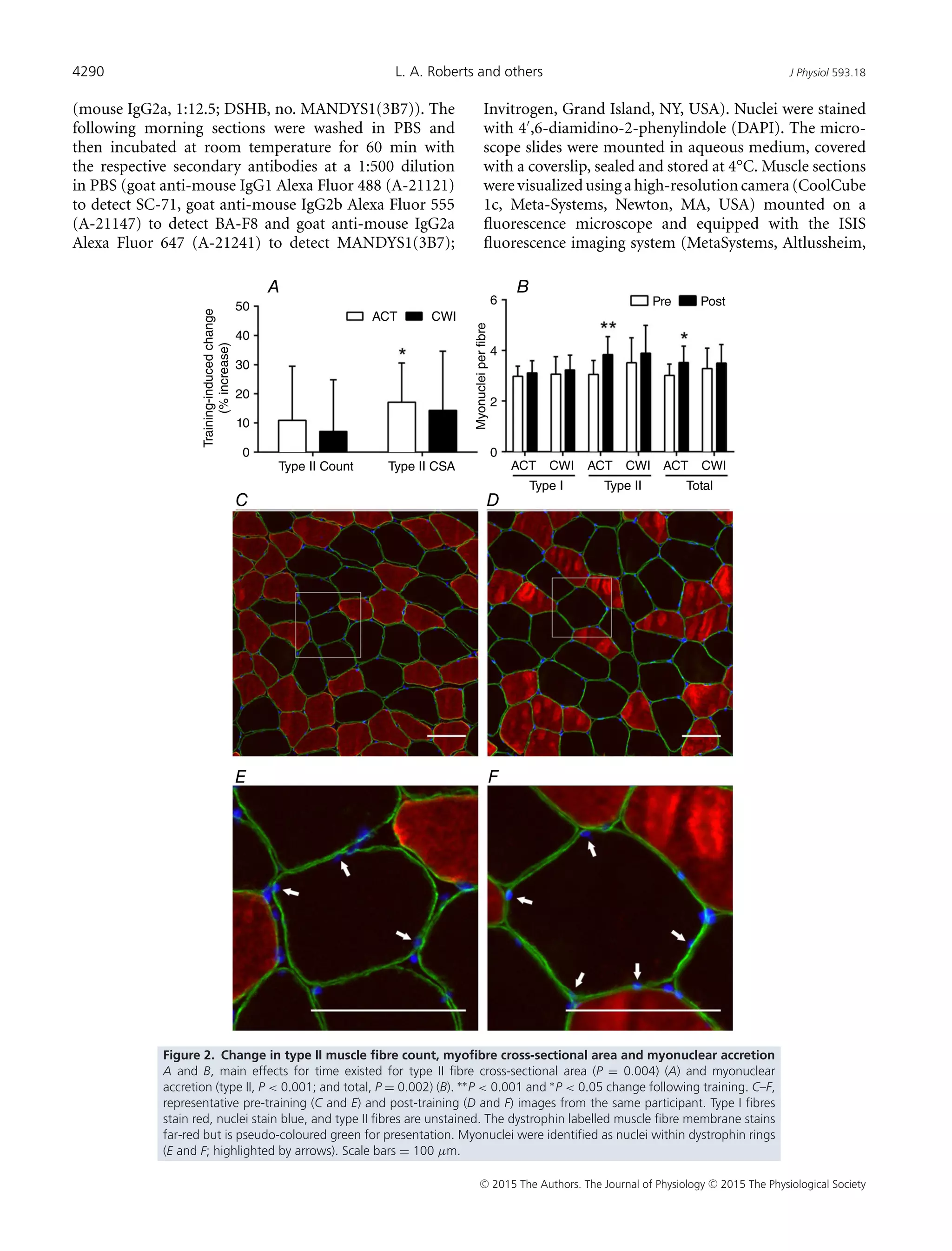 Post exercise cold water immersion attenuates acute anabolic signalli…