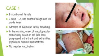 Post Cough Rash POST-EXPOSURE PROPHYLAXIS PPT.pptx