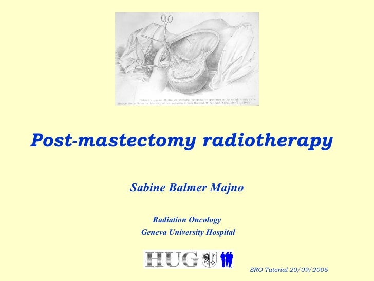 Post Mastectomy Radiotherapy
