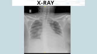 X-RAY
 