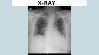 X-RAY
 