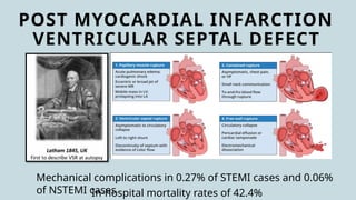 POST MYOCARDIAL INFARCTION
VENTRICULAR SEPTAL DEFECT
Mechanical complications in 0.27% of STEMI cases and 0.06%
of NSTEMI cases
In-hospital mortality rates of 42.4%
 