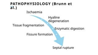 PATHOPHYSIOLOGY (Brunn et
al.)
Ischaemia
Hyaline
degeneration
Tissue fragmentation
Enzymatic digestion
Fissure formation
Septal rupture
 