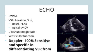 ECHO
• RWMA
• VSR- Location, Size,
• Basal- PLAX
• Apical- A4CV
• L-R shunt magnitude
• Ventricular function
• Doppler- 100% Sensitive
and specific in
differentiating VSR from
 