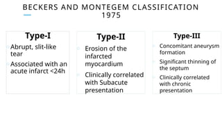 BECKERS AND MONTEGEM CLASSIFICATION
1975
Type-I
o Abrupt, slit-like
tear
o Associated with an
acute infarct <24h
Type-II
o Erosion of the
infarcted
myocardium
o Clinically correlated
with Subacute
presentation
Type-III
o Concomitant aneurysm
formation
o Significant thinning of
the septum
o Clinically correlated
with chronic
presentation
 