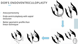 DOR’S ENDOVENTRICULOPLASTY
o Aneurysmectomy
o Endo-ventriculoplasty with septal
exclusion
o Better geometric profile than
linear techniquw
 