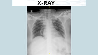 X-RAY
 