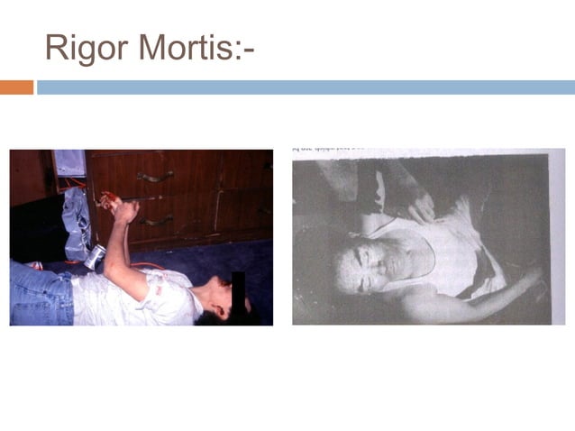 Post Mortem Changes | PPT | Death, Injury, or Military Conflict ...