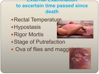 External Examination to ascertain time passed since deathRectal Temperature Hypostasis Rigor Mortis Stage of PutrefactionOva of flies and maggots