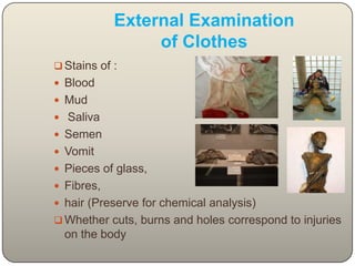 External Examination of ClothesStains of : Blood MudSaliva Semen Vomit Pieces of glass, Fibres, hair (Preserve for chemical analysis) Whether cuts, burns and holes correspond to injuries on the bodyExternal Examination of EyesSoftening of eye ball Opacity of cornea Opacity of lens