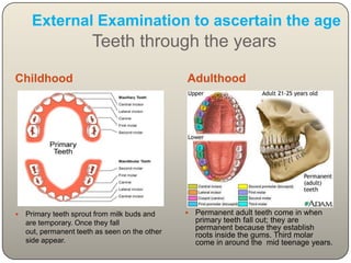 Individual CharacteristicsSize of tooth