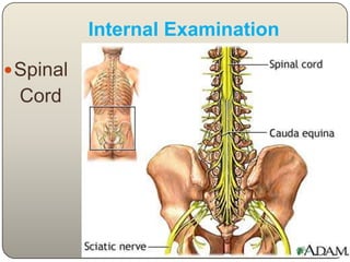 Sternum fracture Internal Examination  of ThoraxPleural Cavities- for blood, fluidLungs- Collapsed, Full, Water