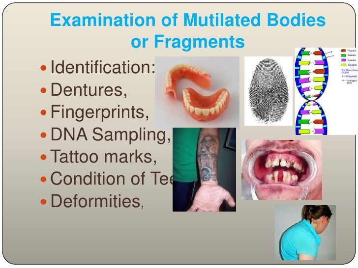 Post mortem examination(autopsy)