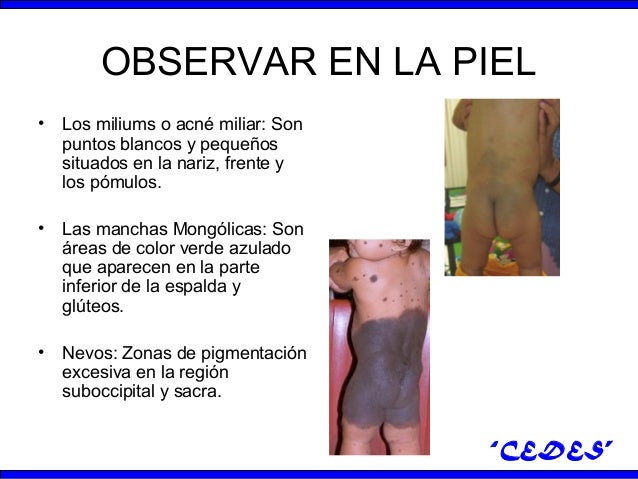 Una fuerte crema para el blanqueamiento de la piel