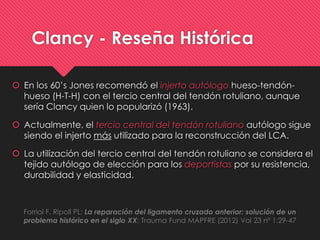Clancy - Reseña Histórica
 En los 60’s Jones recomendó el injerto autólogo hueso-tendón-
hueso (H-T-H) con el tercio central del tendón rotuliano, aunque
sería Clancy quien lo popularizó (1963).
 Actualmente, el tercio central del tendón rotuliano autólogo sigue
siendo el injerto más utilizado para la reconstrucción del LCA.
 La utilización del tercio central del tendón rotuliano se considera el
tejido autólogo de elección para los deportistas por su resistencia,
durabilidad y elasticidad.
Forriol F, Ripoll PL; La reparación del ligamento cruzado anterior: solución de un
problema histórico en el siglo XX; Trauma Fund MAPFRE (2012) Vol 23 nº 1:29-47
 