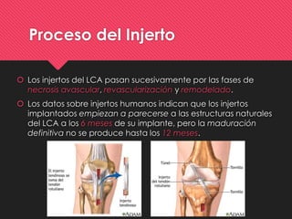 Proceso del Injerto
 Los injertos del LCA pasan sucesivamente por las fases de
necrosis avascular, revascularización y remodelado.
 Los datos sobre injertos humanos indican que los injertos
implantados empiezan a parecerse a las estructuras naturales
del LCA a los 6 meses de su implante, pero la maduración
definitiva no se produce hasta los 12 meses.
 