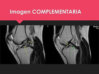 Imagen COMPLEMENTARIA
 