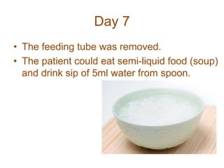 Day 7
• The feeding tube was removed.
• The patient could eat semi-liquid food (soup)
and drink sip of 5ml water from spoon.
 
