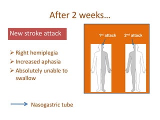 After 2 weeks…
New stroke attack
 Right hemiplegia
 Increased aphasia
 Absolutely unable to
swallow
Nasogastric tube
1st attack 2nd attack
 