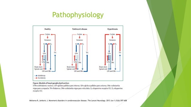 Post-stroke Movement Disorders | PPT